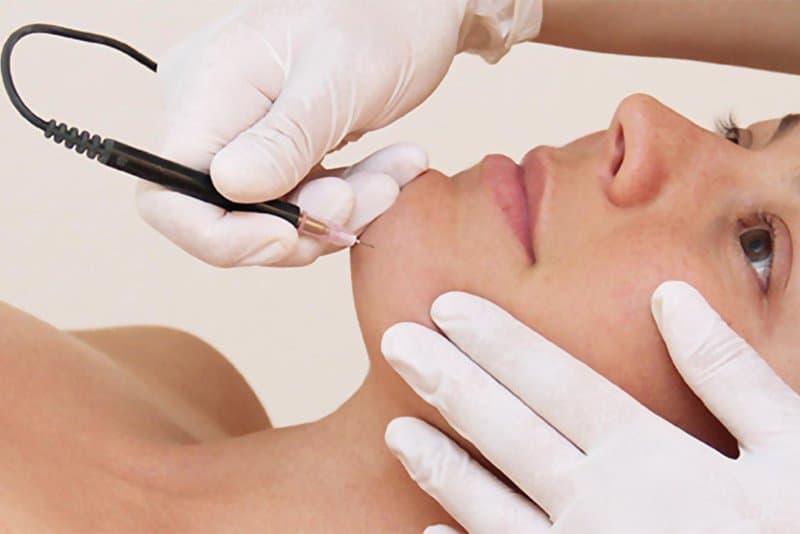 Smoothness Itself: choosing the best hair removal method for the first time. Is It Possible To Permanently Remove Hair?