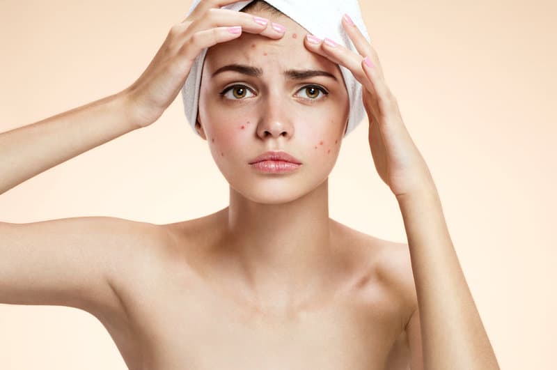 Skincare Diet – a New Trend for Beauty lovers